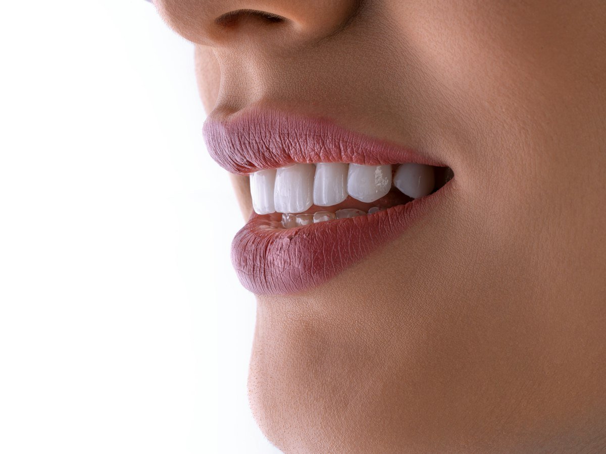 Close-up of a smile with bright white teeth